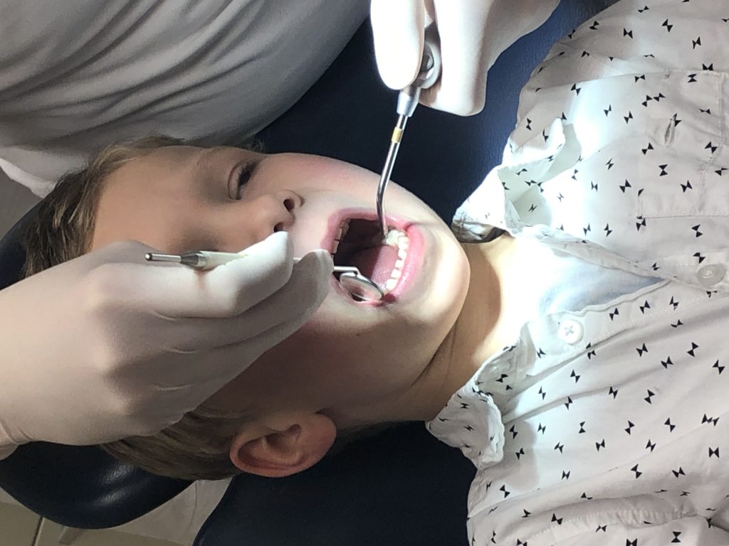 melkgebit tanden wisselen, tandarts