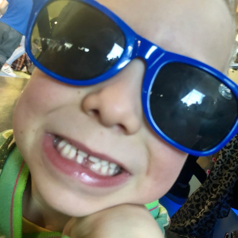 Tanden wisselen: Van melkgebit naar het grote mensen gebit in mum van tijd